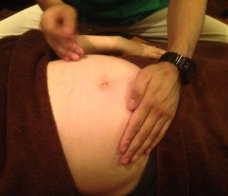 前置胎盤＿疫学