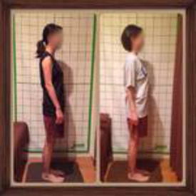 姿勢矯正時のビフォーアフターの画像