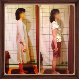 姿勢矯正のビフォーアフターの画像