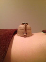 お灸施術時の画像